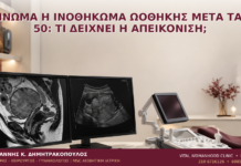 Ίνωμα ή Ινοθήκωμα Ωοθήκης μετά τα 50: Τι Δείχνει η Απεικόνιση; - Δρ. Ιωάννης Κ. Δημητρακόπουλος
