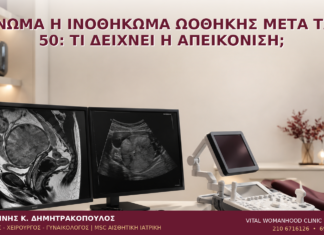Ίνωμα ή Ινοθήκωμα Ωοθήκης μετά τα 50: Τι Δείχνει η Απεικόνιση; Ίνωμα ή Ινοθήκωμα Ωοθήκης μετά τα 50: Τι Δείχνει η Απεικόνιση; - Δρ. Ιωάννης Κ. Δημητρακόπουλος
