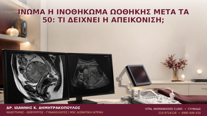 Ίνωμα ή Ινοθήκωμα Ωοθήκης μετά τα 50: Τι Δείχνει η Απεικόνιση; - Δρ. Ιωάννης Κ. Δημητρακόπουλος
