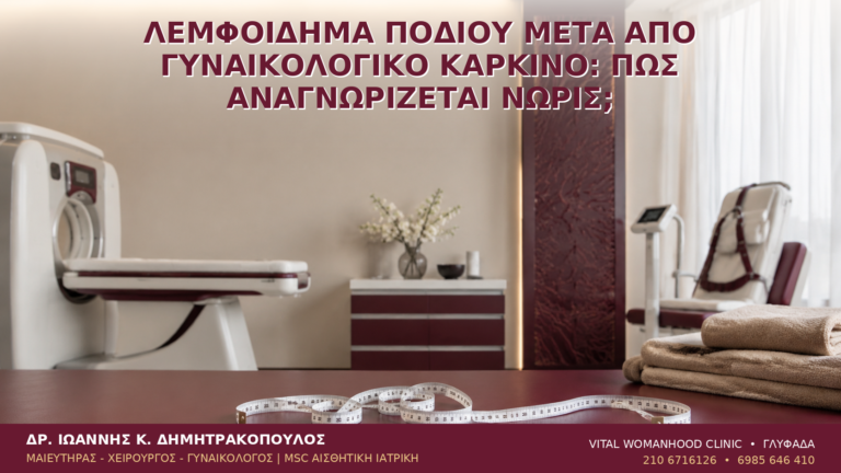 Λεμφοίδημα Ποδιού μετά από Γυναικολογικό Καρκίνο: Πώς Αναγνωρίζεται Νωρίς; - Δρ. Ιωάννης Κ. Δημητρακόπουλος