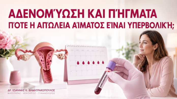 Αδενομύωση και Πήγματα: Πότε η Απώλεια Αίματος Είναι Υπερβολική; Αδενομύωση και Πήγματα: Πότε η Απώλεια Αίματος Είναι Υπερβολική; - Δρ. Ιωάννης Κ. Δημητρακόπουλος
