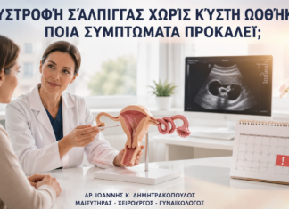 Συστροφή Σάλπιγγας χωρίς Κύστη Ωοθήκης: Ποια Συμπτώματα Προκαλεί; Συστροφή Σάλπιγγας χωρίς Κύστη Ωοθήκης: Ποια Συμπτώματα Προκαλεί; - Δρ. Ιωάννης Κ. Δημητρακόπουλος