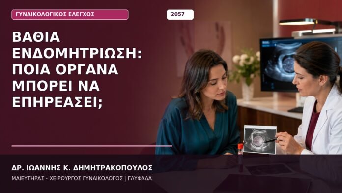Βαθιά Ενδομητρίωση: Ποια Όργανα Μπορεί να Επηρεάσει; Βαθιά Ενδομητρίωση: Ποια Όργανα Μπορεί να Επηρεάσει;