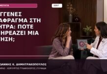διάφραγμα μήτρας