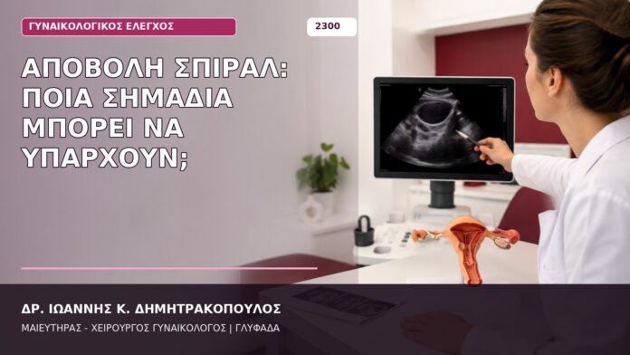 αποβολή σπιράλ