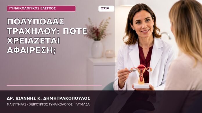 Πολύποδας Τραχήλου: Πότε Χρειάζεται Αφαίρεση; πολύποδας τραχήλου
