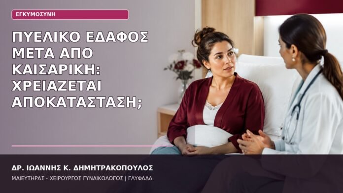 Πυελικό Έδαφος μετά από Καισαρική: Χρειάζεται Αποκατάσταση; πυελικό έδαφος μετά από καισαρική