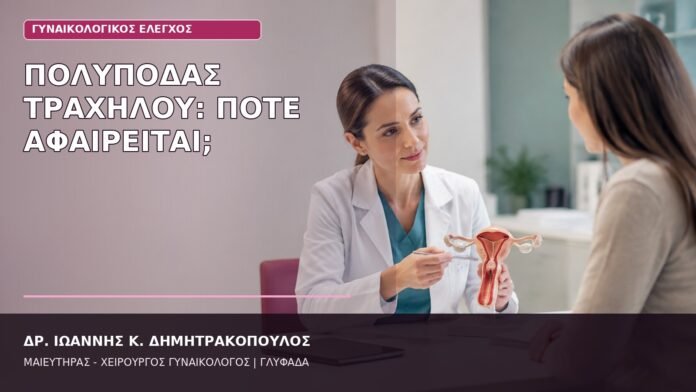 πολύποδας τραχήλου αφαίρεση