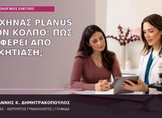 λειχήνας planus κόλπος