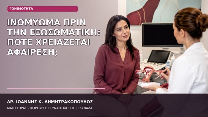 Ινομύωμα πριν την Εξωσωματική: Πότε Χρειάζεται Αφαίρεση; ινομύωμα πριν την εξωσωματική