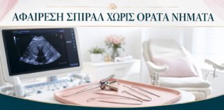 Αφαίρεση Σπιράλ όταν Δεν Φαίνονται τα Νήματα: Ποια Είναι τα Βήματα;