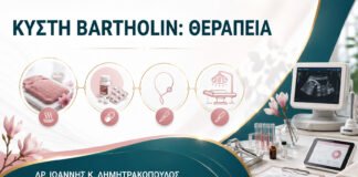Αφαίρεση Κύστης Bartholin: Πότε Γίνεται Παροχέτευση ή Μαρσιποποίηση;