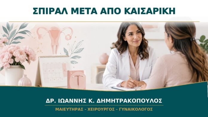 Τοποθέτηση Σπιράλ μετά από Καισαρική: Πότε Είναι Κατάλληλη;