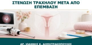 Στένωση Τραχήλου μετά από Επέμβαση: Πότε Δυσκολεύει το Παπ ή την Υστεροσκόπηση;