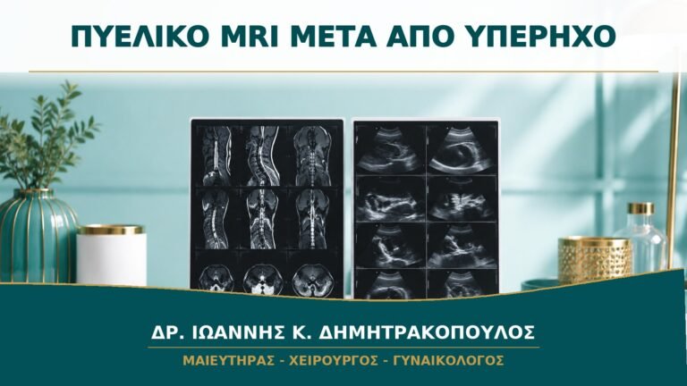 Πυελικό MRI μετά από Υπέρηχο: Πότε Προσθέτει Χρήσιμες Πληροφορίες;