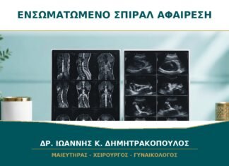 Ενσωματωμένο Σπιράλ στο Μυομήτριο: Πότε Αφαιρείται με Υστεροσκόπηση; Ενσωματωμένο Σπιράλ στο Μυομήτριο: Πότε Αφαιρείται με Υστεροσκόπηση;
