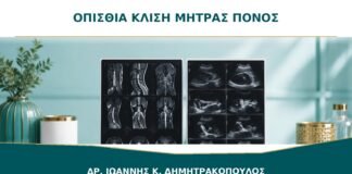 Οπίσθια Κλίση Μήτρας και Πόνος: Πότε Είναι Απλώς Ανατομική Παραλλαγή;