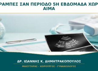 Κράμπες σαν Περίοδο χωρίς Αίμα στην Πέμπτη Εβδομάδα: Πότε Είναι Αναμενόμενες; Κράμπες σαν Περίοδο χωρίς Αίμα στην Πέμπτη Εβδομάδα: Πότε Είναι Αναμενόμενες;