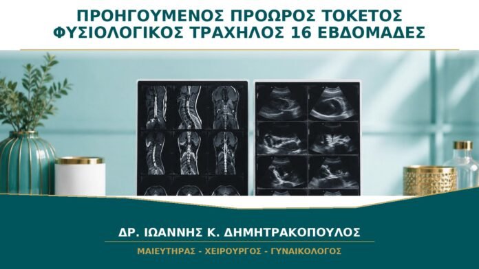 Προηγούμενος Πρόωρος Τοκετός και Φυσιολογικός Τράχηλος στις 16 Εβδομάδες: Τι Παρακολουθείται;
