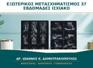 Εξωτερικός Μετασχηματισμός στις 37 Εβδομάδες: Πότε Μπορεί να Γυρίσει Ισχιακό Μωρό; Εξωτερικός Μετασχηματισμός στις 37 Εβδομάδες: Πότε Μπορεί να Γυρίσει Ισχιακό Μωρό;