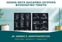 Λόχεια μετά από Καισαρική: Είναι Λιγότερα από τον Φυσιολογικό Τοκετό; Λόχεια μετά από Καισαρική: Είναι Λιγότερα από τον Φυσιολογικό Τοκετό;