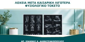 Λόχεια μετά από Καισαρική: Είναι Λιγότερα από τον Φυσιολογικό Τοκετό;