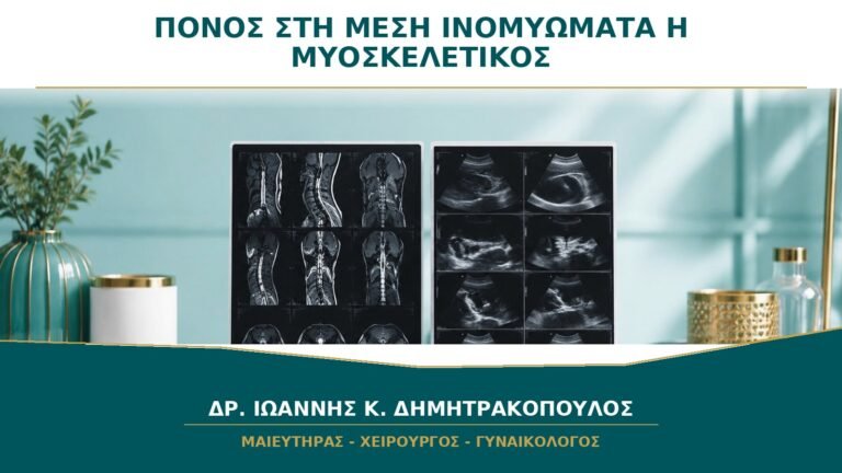 Πόνος στη Μέση με Ινομυώματα: Πώς Ξεχωρίζει από Μυοσκελετικό Πόνο;
