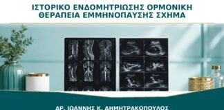 Ιστορικό Ενδομητρίωσης και Ορμονική Θεραπεία Εμμηνόπαυσης: Τι Αλλάζει στο Σχήμα;