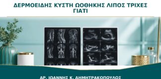 Δερμοειδής Κύστη Ωοθήκης: Γιατί Μπορεί να Περιέχει Λίπος ή Τρίχες;