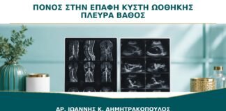 Πόνος στην Επαφή με Κύστη Ωοθήκης: Παίζει Ρόλο η Πλευρά και το Βάθος;