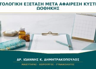 Ιστολογική Εξέταση μετά από Αφαίρεση Κύστης Ωοθήκης: Τι Μπορεί να Δείξει; Ιστολογική Εξέταση μετά από Αφαίρεση Κύστης Ωοθήκης: Τι Μπορεί να Δείξει;