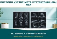 Υποτροπή Κύστης μετά από Κυστεκτομή: Είναι η Ίδια ή Νέο Εύρημα; Υποτροπή Κύστης μετά από Κυστεκτομή: Είναι η Ίδια ή Νέο Εύρημα;