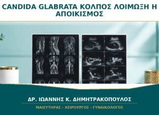 Candida glabrata στον Κόλπο: Πότε Είναι Λοίμωξη και Πότε Αποικισμός;