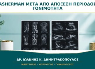 Σύνδρομο Asherman μετά από Απόξεση: Πότε Επηρεάζει την Περίοδο και τη Γονιμότητα;