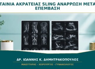 Ταινία Ακράτειας Sling: Πόσο Διαρκεί η Ανάρρωση μετά την Επέμβαση; Ταινία Ακράτειας Sling: Πόσο Διαρκεί η Ανάρρωση μετά την Επέμβαση;