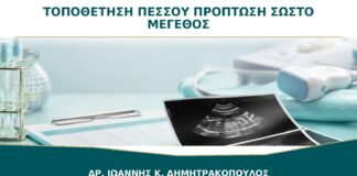 Τοποθέτηση Πεσσού για Πρόπτωση: Πώς Επιλέγεται το Σωστό Μέγεθος;