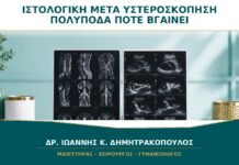 Βιοψία ή Πολύποδας στην Υστεροσκόπηση: Πότε Βγαίνει η Ιστολογική; Βιοψία ή Πολύποδας στην Υστεροσκόπηση: Πότε Βγαίνει η Ιστολογική;