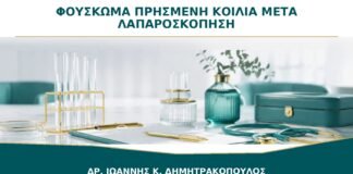 Φούσκωμα και Πρησμένη Κοιλιά μετά από Λαπαροσκόπηση: Πότε Υποχωρούν;