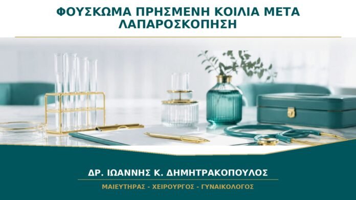 Φούσκωμα και Πρησμένη Κοιλιά μετά από Λαπαροσκόπηση: Πότε Υποχωρούν;