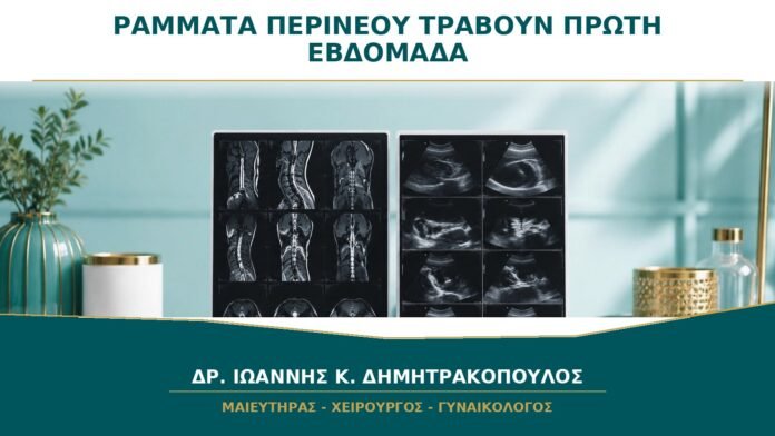 gynaikologikes-ypiresies-b43-17 Ράμματα περινέου που τραβούν την πρώτη εβδομάδα: τι θεωρείται αναμενόμενο;