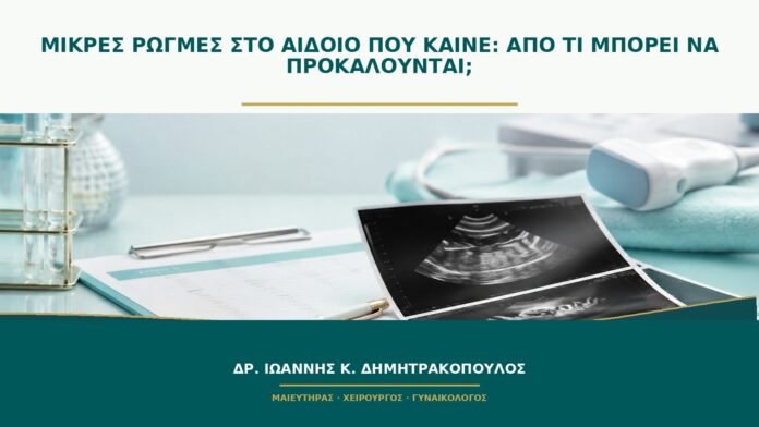 gynaikologikes-ypiresies-b48-16 Μικρές ρωγμές στο αιδοίο που καίνε: από τι μπορεί να προκαλούνται;