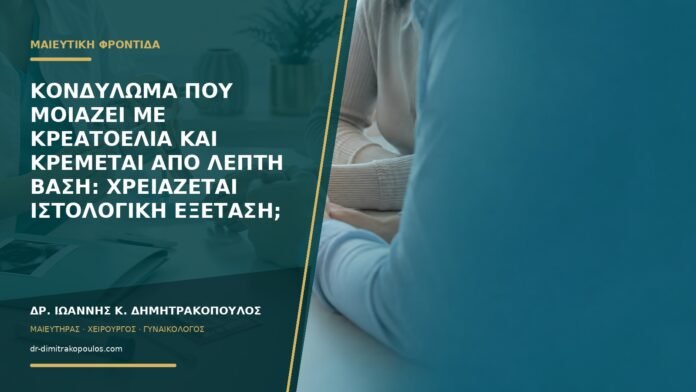 gynaikologikes-ypiresies-b59-22 Κονδύλωμα που μοιάζει με κρεατοελιά και κρέμεται από λεπτή βάση: χρειάζεται ιστολογική εξέταση;