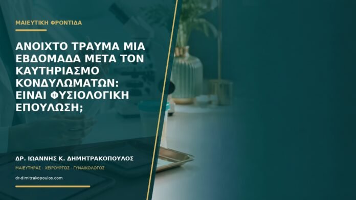 Ανοιχτό τραύμα μία εβδομάδα μετά τον καυτηριασμό κονδυλωμάτων: είναι φυσιολογική επούλωση;