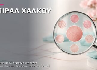 Σπιράλ Χαλκού: Τοποθέτηση και Παρακολούθηση Σπιράλ Χαλκού: Τοποθέτηση και Παρακολούθηση