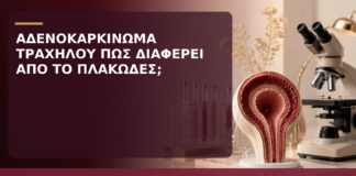 Αδενοκαρκίνωμα Τραχήλου: Πώς Διαφέρει από το Πλακώδες Καρκίνωμα; - Δρ. Ιωάννης Κ. Δημητρακόπουλος