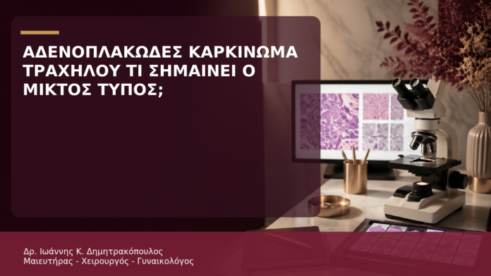 Αδενοπλακώδες Καρκίνωμα Τραχήλου: Τι Σημαίνει ο Μικτός Ιστολογικός Τύπος; Αδενοπλακώδες Καρκίνωμα Τραχήλου: Τι Σημαίνει ο Μικτός Ιστολογικός Τύπος; - Δρ. Ιωάννης Κ. Δημητρακόπουλος