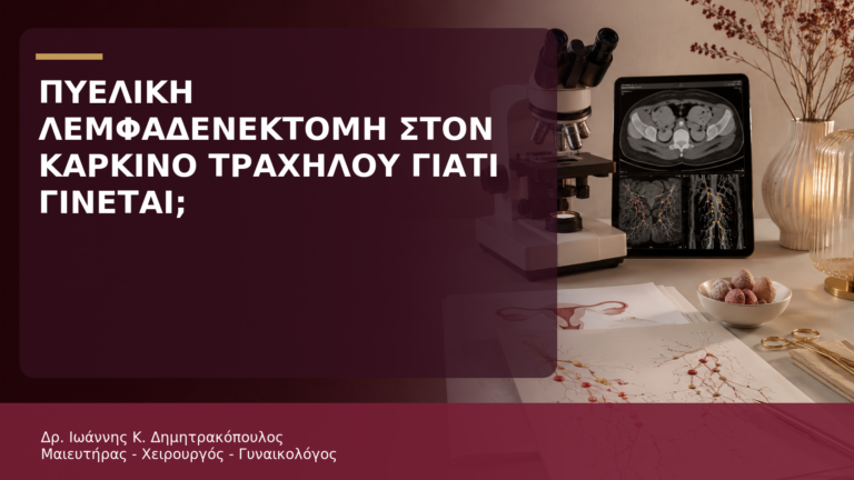 Πυελική Λεμφαδενεκτομή στον Καρκίνο Τραχήλου: Γιατί Γίνεται; - Δρ. Ιωάννης Κ. Δημητρακόπουλος