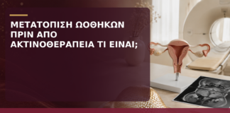 Μετατόπιση Ωοθηκών πριν από Ακτινοθεραπεία Τραχήλου: Τι Είναι; - Δρ. Ιωάννης Κ. Δημητρακόπουλος