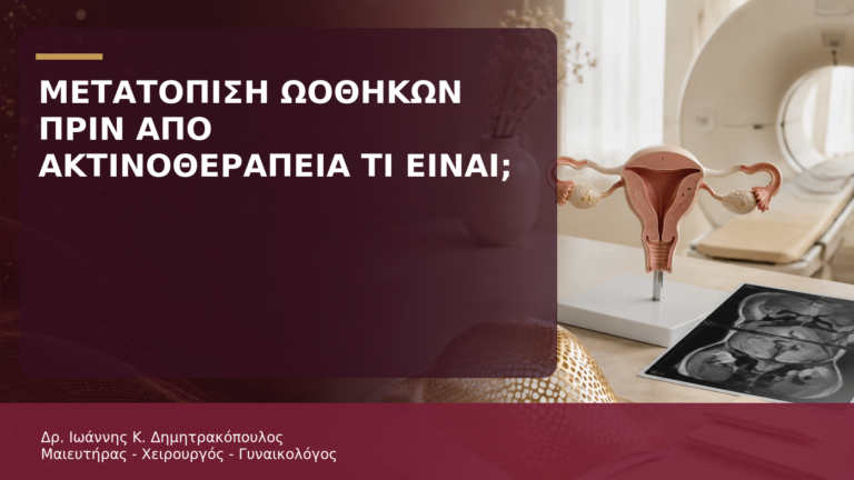 Μετατόπιση Ωοθηκών πριν από Ακτινοθεραπεία Τραχήλου: Τι Είναι; - Δρ. Ιωάννης Κ. Δημητρακόπουλος