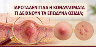 Ιδρωταδενίτιδα ή Κονδυλώματα: Τι Δείχνουν τα Επώδυνα Οζίδια; - Δρ. Ιωάννης Κ. Δημητρακόπουλος
